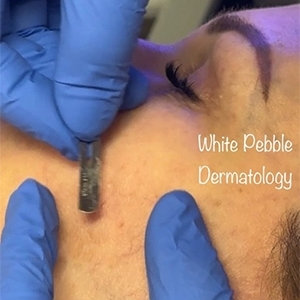 The state-of-the-art laser technology from your trusted dermatology in Columbia MD